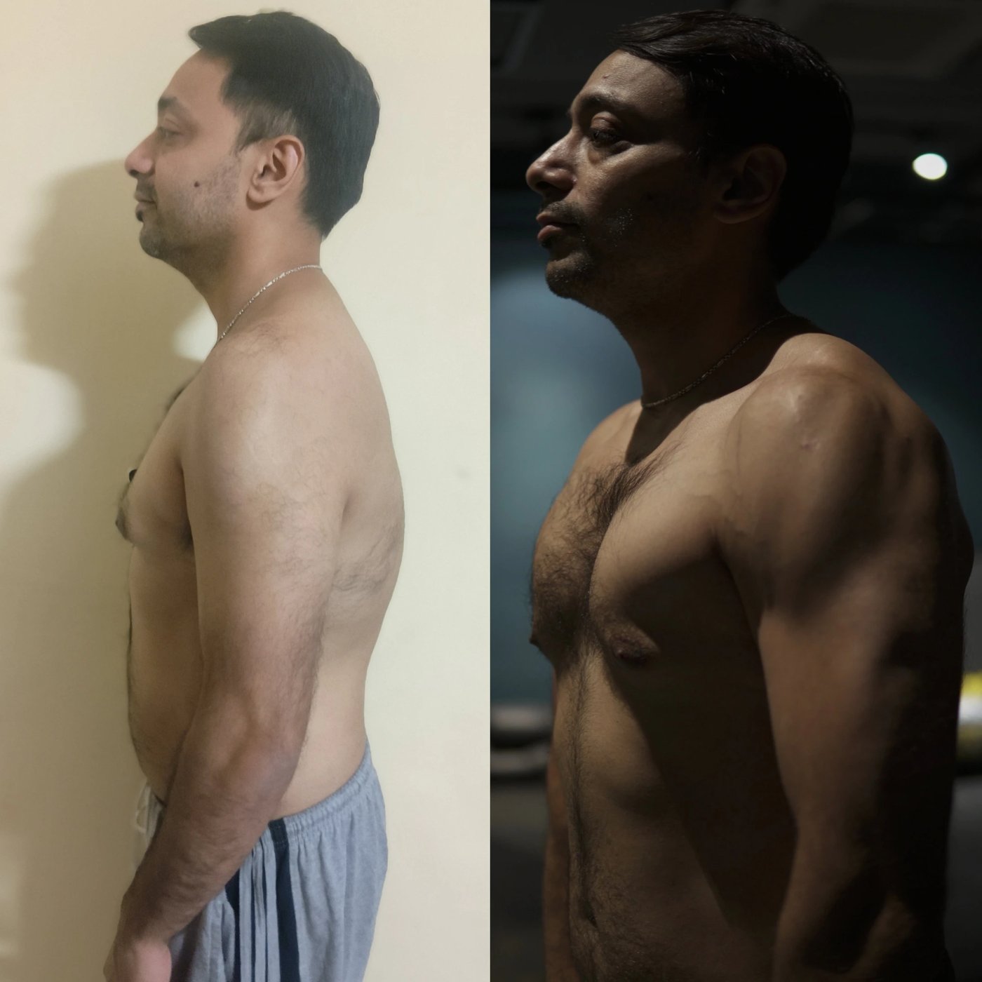 Case Study 01 — before and after side-profile transformation
